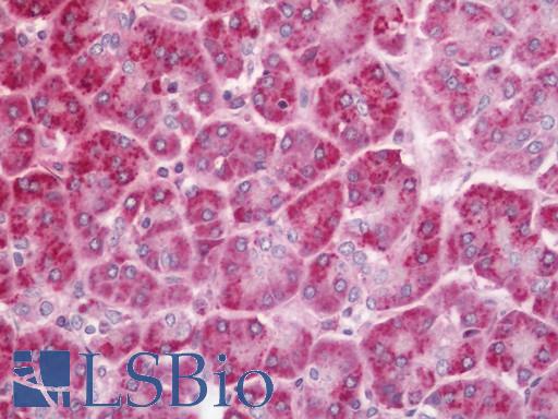 Human Pancreas: Formalin-Fixed, Paraffin-Embedded (FFPE)