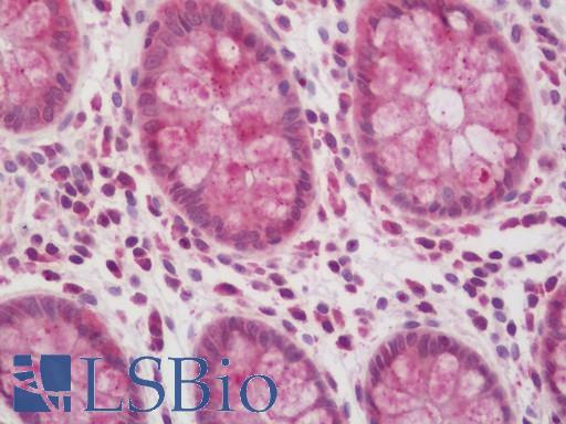 Human Colon: Formalin-Fixed, Paraffin-Embedded (FFPE)