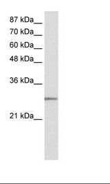 Transfected 293T Cell Lysate