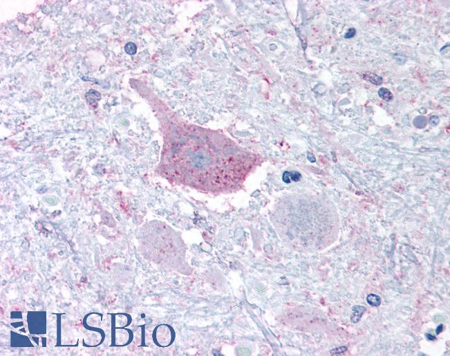 Anti-MRGPRD antibody LS-A4128 IHC of human brain, medulla. Immunohistochemistry of formalin-fixed, paraffin-embedded tissue after heat-induced antigen retrieval.