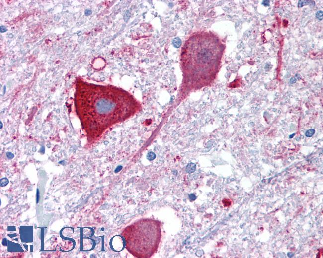 Anti-MRGPRD antibody LS-A4123 IHC of human brain, medulla. Immunohistochemistry of formalin-fixed, paraffin-embedded tissue after heat-induced antigen retrieval.