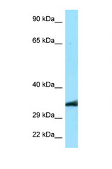 MRGPRE antibody LS-C146125 Western blot of A549 Cell lysate. Antibody concentration 1 ug/ml.