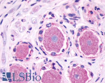 Anti-MRGPRE antibody LS-A4245 IHC of human dorsal root ganglion. Immunohistochemistry of formalin-fixed, paraffin-embedded tissue after heat-induced antigen retrieval.