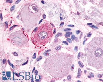Anti-MRGPRE antibody LS-A4343 IHC of human dorsal root ganglion. Immunohistochemistry of formalin-fixed, paraffin-embedded tissue after heat-induced antigen retrieval.
