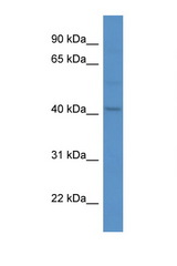MRGPRF antibody LS-C135659 Western blot of H226 Cell lysate. Antibody concentration 1 ug/ml.