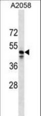MRGPRF Antibody western blot of A2058 cell line lysates (35 ug/lane). The MRGPRF Antibody detected the MRGPRF protein (arrow).