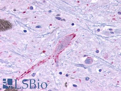 Anti-MRGPRF antibody LS-A2173 IHC of human brain, neurons and glia. Immunohistochemistry of formalin-fixed, paraffin-embedded tissue after heat-induced antigen retrieval.