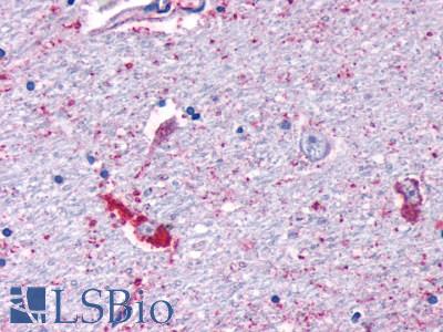 Anti-MRGPRF antibody LS-A1983 IHC of human brain, neurons and glia. Immunohistochemistry of formalin-fixed, paraffin-embedded tissue after heat-induced antigen retrieval.
