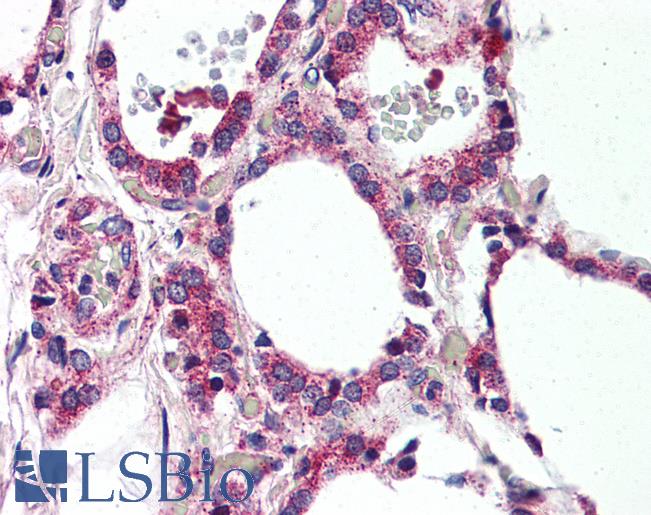 Anti-MRGPRF antibody LS-A1977 IHC of human thyroid. Immunohistochemistry of formalin-fixed, paraffin-embedded tissue after heat-induced antigen retrieval.