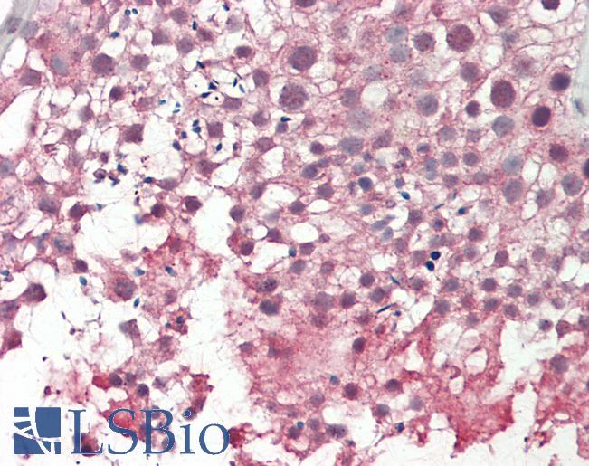 Human Testis: Formalin-Fixed, Paraffin-Embedded (FFPE)