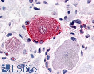 Anti-MRGPRX2 / MRGX2 antibody LS-A2750 IHC of human spinal cord, dorsal root ganglion. Immunohistochemistry of formalin-fixed, paraffin-embedded tissue after heat-induced antigen retrieval.