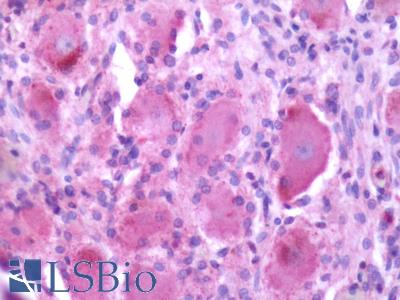 Anti-MRGPRX2 / MRGX2 antibody LS-A6645 IHC of human spinal cord, dorsal root ganglion. Immunohistochemistry of formalin-fixed, paraffin-embedded tissue after heat-induced antigen retrieval.
