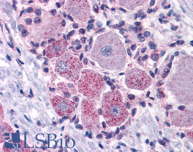 Anti-MRGPRX2 / MRGX2 antibody LS-A6644 IHC of human spinal cord, dorsal root ganglion. Immunohistochemistry of formalin-fixed, paraffin-embedded tissue after heat-induced antigen retrieval.