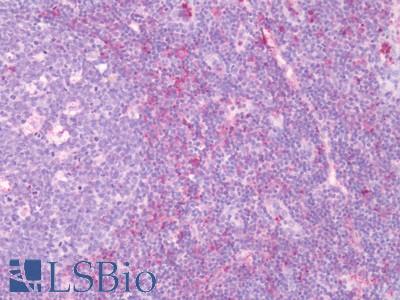 Human Tonsil: Formalin-Fixed, Paraffin-Embedded (FFPE)