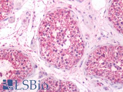 Human Testis: Formalin-Fixed, Paraffin-Embedded (FFPE)