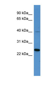 MRGPRX3 / MRGX3 antibody LS-C135660 Western blot of HeLa lysate.