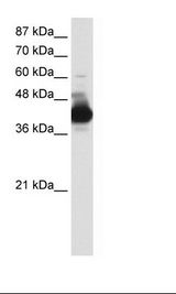 Jurkat Cell Lysate