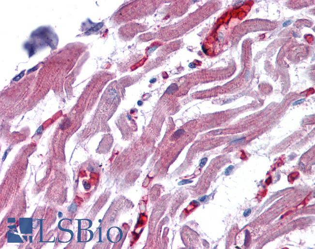 Anti-RAE1 antibody IHC of human heart. Immunohistochemistry of formalin-fixed, paraffin-embedded tissue after heat-induced antigen retrieval. Antibody LS-B4325 concentration 3.75 ug/ml.