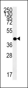 MC2R Antibody western blot of WiDr cell line lysates (15 ug/lane). The MC2R antibody detected the MC2R protein (arrow).