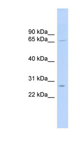 MRPL13 antibody LS-C111590 Western blot of 721_B cell lysate.
