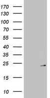HEK293T cells were transfected with the pCMV6-ENTRY control (Left lane) or pCMV6-ENTRY MRPL13 (Right lane) cDNA for 48 hrs and lysed. Equivalent amounts of cell lysates (5 ug per lane) were separated by SDS-PAGE and immunoblotted with anti-MRPL13.
