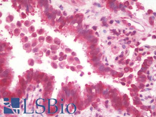 Anti-MRPL13 antibody IHC staining of human lung. Immunohistochemistry of formalin-fixed, paraffin-embedded tissue after heat-induced antigen retrieval. Antibody LS-B9682 concentration 10 ug/ml.