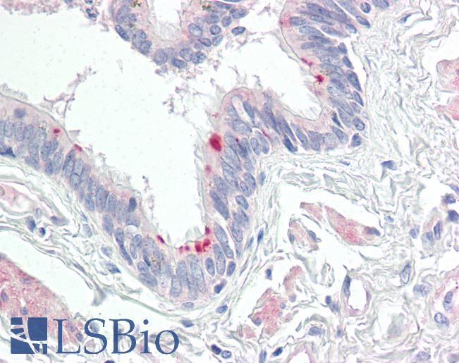 Anti-MRPL24 antibody IHC of human lung, respiratory epithelium. Immunohistochemistry of formalin-fixed, paraffin-embedded tissue after heat-induced antigen retrieval. Antibody LS-B8537 dilution 5 ug/ml.