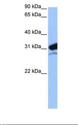 721_B cell lysate. Antibody concentration: 0.5 ug/ml. Gel concentration: 12%.
