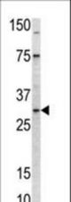 Western blot of anti-MRPL24 antibody in mouse kidney tissue lysate (35 ug/lane). MRPL24 (arrow) was detected using the purified antibody.