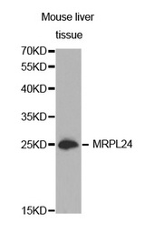 Western blot analysis of extracts of Mouse liver tissue cell line, using MRPL24 antibody.