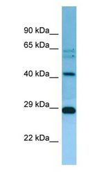 MRPL38 antibody Western Blot of Jurkat.