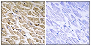 IHC of paraffin-embedded human heart tissue, using MRPL39 Antibody. The picture on the right is treated with the synthesized peptide.