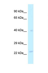 MRPL40 antibody LS-C145827 Western blot of Fetal Liver lysate. Antibody concentration 1 ug/ml.
