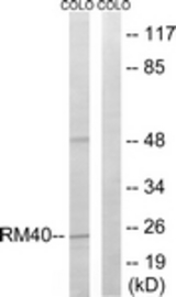 Western blot of extracts from COLO cells, using MRPL40 Antibody. The lane on the right is treated with the synthesized peptide.