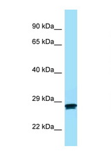 MC2R antibody LS-C146488 Western blot of Fetal Kidney lysate. Antibody concentration 1 ug/ml.