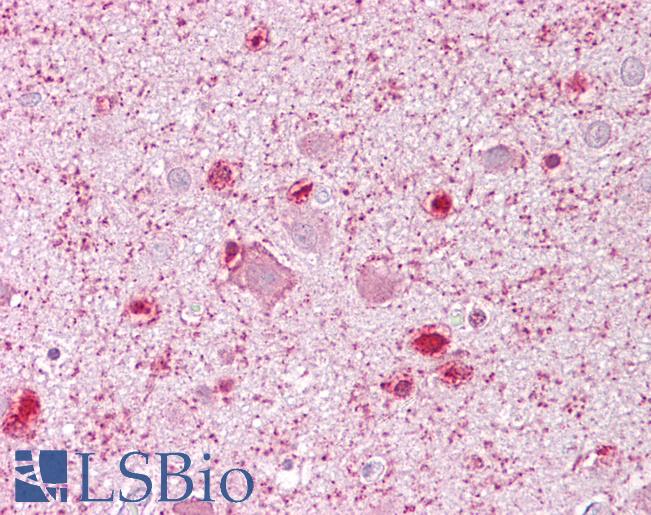 Anti-MCM3 antibody IHC of human brain, cortex. Immunohistochemistry of formalin-fixed, paraffin-embedded tissue after heat-induced antigen retrieval. Antibody LS-B6800 concentration 5 ug/ml.