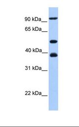 721_B cell lysate. Antibody concentration: 1.0 ug/ml. Gel concentration: 12%.