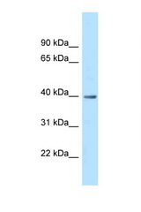 MRPS9 antibody LS-C145894 Western blot of Fetal Heart lysate. Antibody concentration 1 ug/ml.