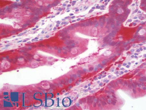Anti-MRPS9 antibody IHC staining of human small intestine. Immunohistochemistry of formalin-fixed, paraffin-embedded tissue after heat-induced antigen retrieval. Antibody LS-B9679 concentration 10 ug/ml.