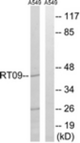 Western blot of extracts from A549 cells, using MRPS9 Antibody. The lane on the right is treated with the synthesized peptide.