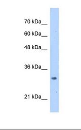Jurkat cell lysate. Antibody concentration: 2.5 ug/ml. Gel concentration: 12%.