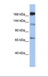 721_B cell lysate. Antibody concentration: 1.0 ug/ml. Gel concentration: 6-18%.