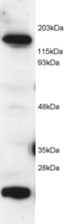 Antibody (2 ug/ml) staining of HeLa lysate (RIPA buffer, 1.4E5 cells per lane). Detected by Western blot of chemiluminescence.