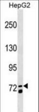 MS4A14 Antibody western blot of HepG2 cell line lysates (35 ug/lane). The MS4A14 antibody detected the MS4A14 protein (arrow).