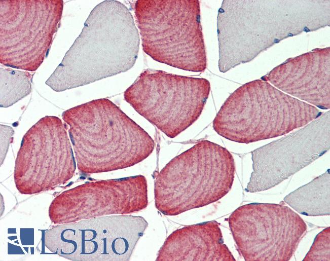 Human, Skeletal muscle: Formalin-Fixed Paraffin-Embedded (FFPE)