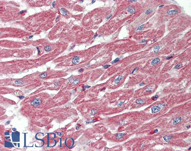 Human, Heart: Formalin-Fixed Paraffin-Embedded (FFPE)