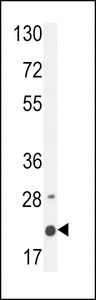 M4A4A Antibody western blot of MDA-MB435 cell line lysates (35 ug/lane). The M4A4A antibody detected the M4A4A protein (arrow).