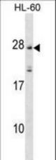 MS4A5 Antibody western blot of HL-60 cell line lysates (35 ug/lane). The MS4A5 antibody detected the MS4A5 protein (arrow).