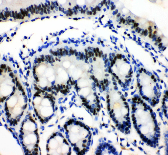 MCM3 antibody. IHC(P): Rat Intestine Tissue.