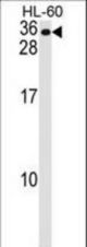 MS4A7 Antibody western blot of HL-60 cell line lysates (35 ug/lane). The MS4A7 antibody detected the MS4A7 protein (arrow).